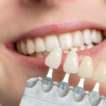 Eine private Zahnzusatzversicherung kann oft sinnvoll sein. Foto ©StudioLaMagica stock adobe